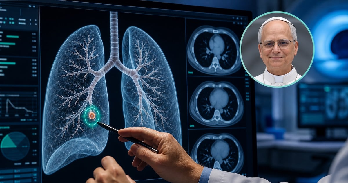 Un punto en el pulmón: cuando la medicina decide operar antes de que crezca
