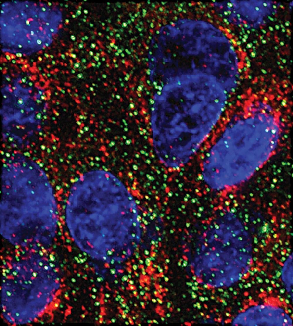 Un freno molecular en el laboratorio abre una nueva pista contra el cáncer de páncreas